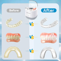 Exluvon Unisex Ultrasonic Dental Retainer Cleaner, 250ml White Portable DEMO