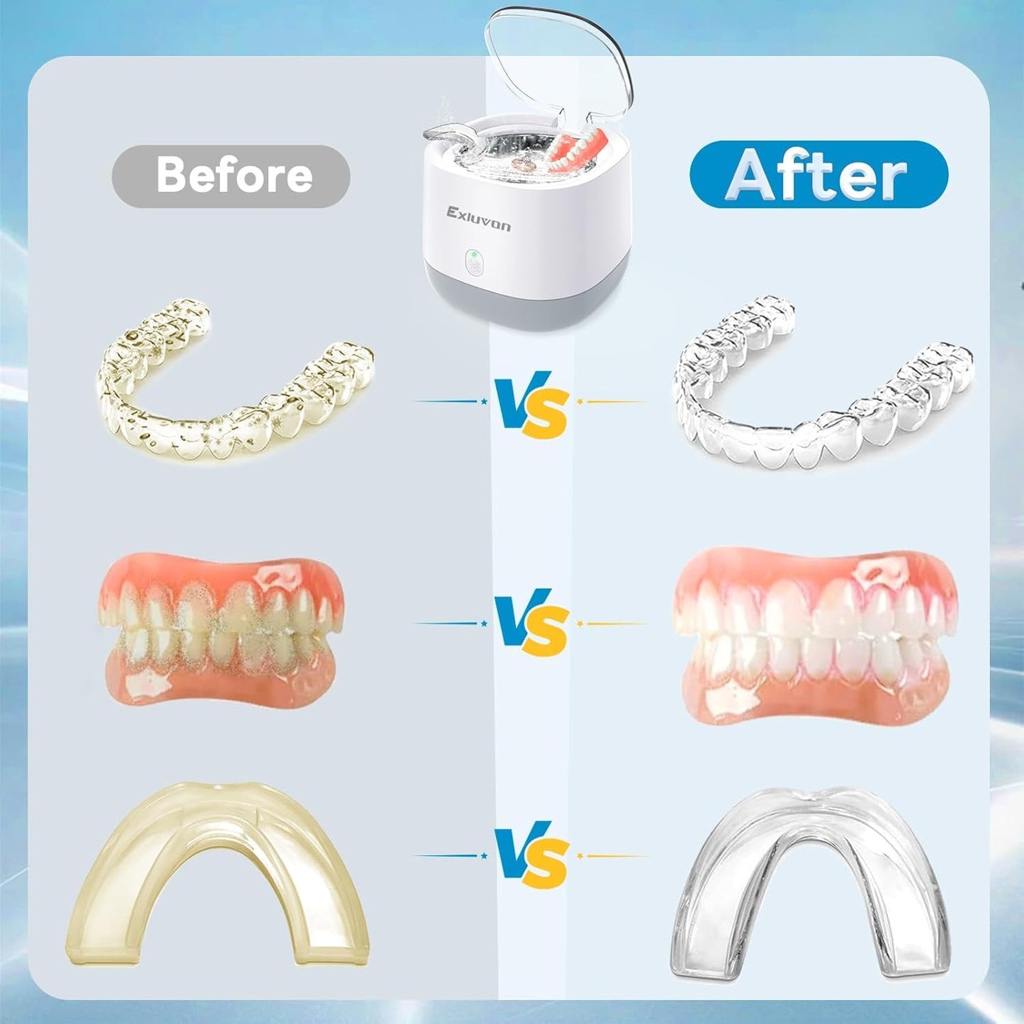 Exluvon Unisex Ultrasonic Dental Retainer Cleaner, 250ml White Portable DEMO